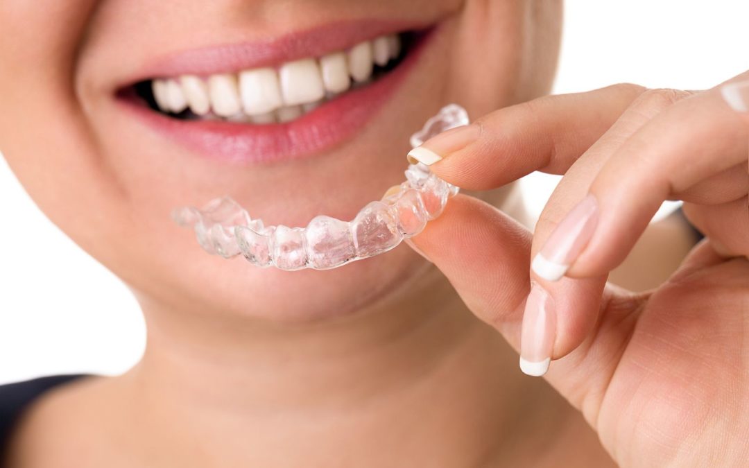 Invisalign Tedavisi